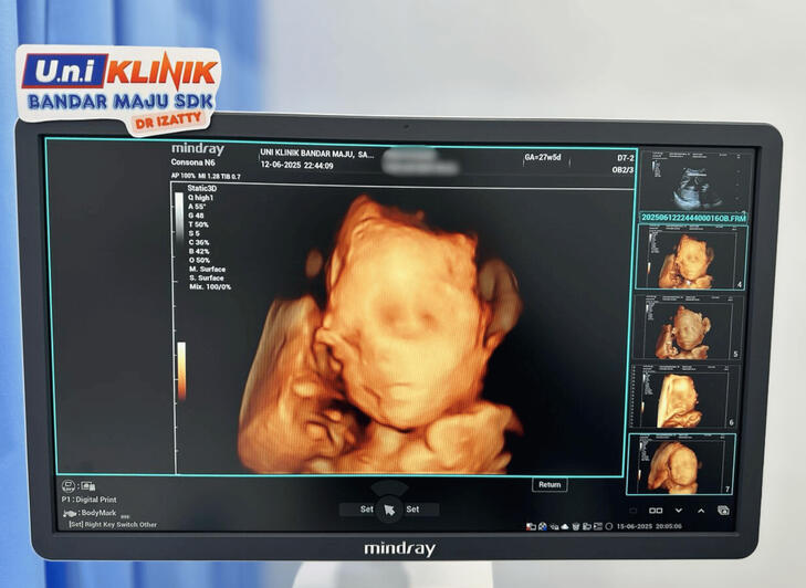 3D 4D 5D 6D SCAN